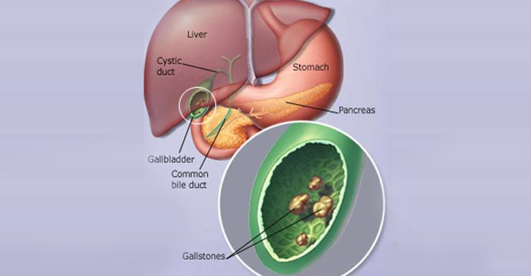 best Gallbladder Surgeon in Faridabad