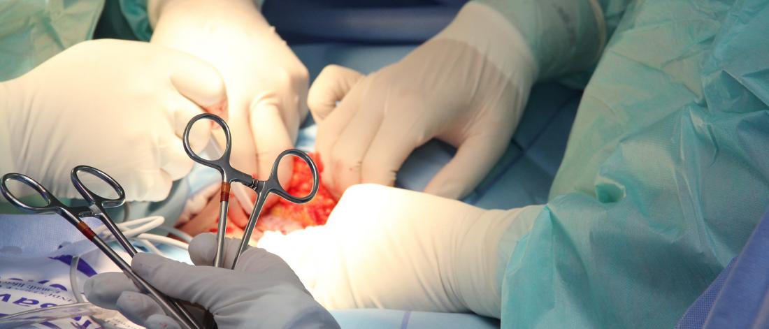 doctor for General Surgery in Faridabad