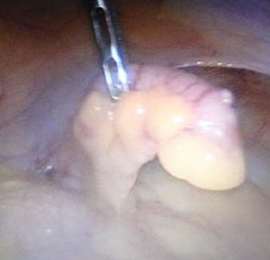 best Thyroid Surgeon in Faridabad